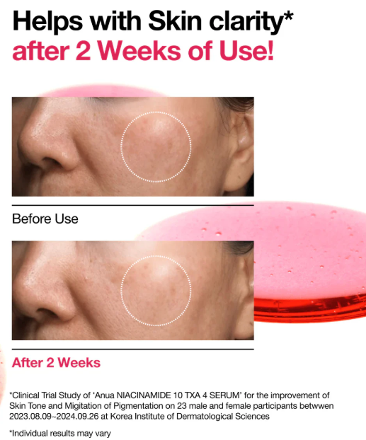 Anua - Niacinamide 10 TXA 4 Serum